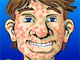 Acne Be Gone
