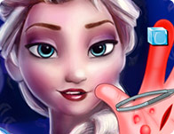 Frozen Elsa Hand Surgery
