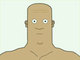 Magneto Syndrome